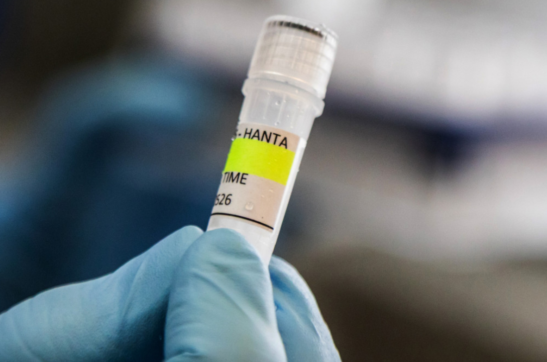 Traitement expérimental envoyé contre le hantavirus